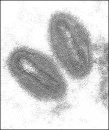 Monkeypox disease Monkeypox disease