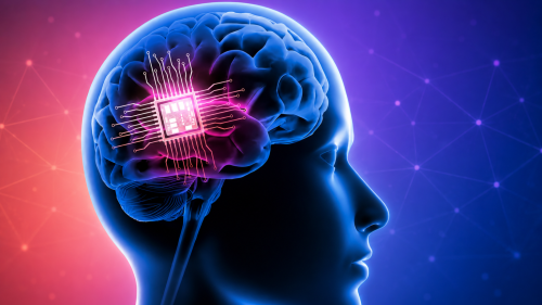 China Beats US to Market on Brain Implants